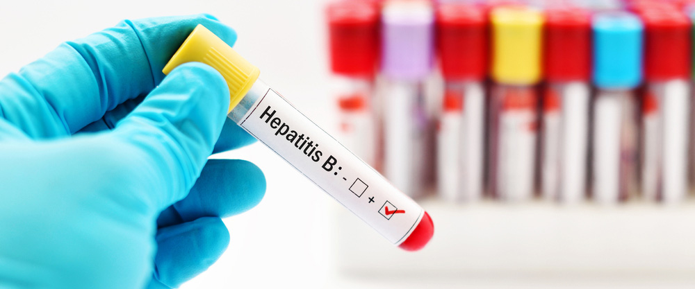 Iyini i-Hepatitis B? Yiziphi izimpawu nezindlela zokwelapha?